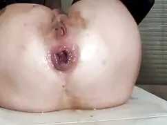 Hemşire hastasını hd porna altyazili boğuyor-Bölüm 3